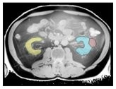 MRI scans of organs MRSegmentator can identify (with the organ highlighted)