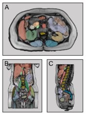 MRI scans of organs MRSegmentator can identify (with the organ highlighted)